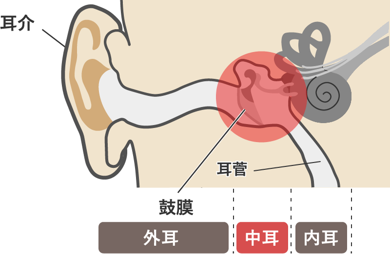 急性中耳炎