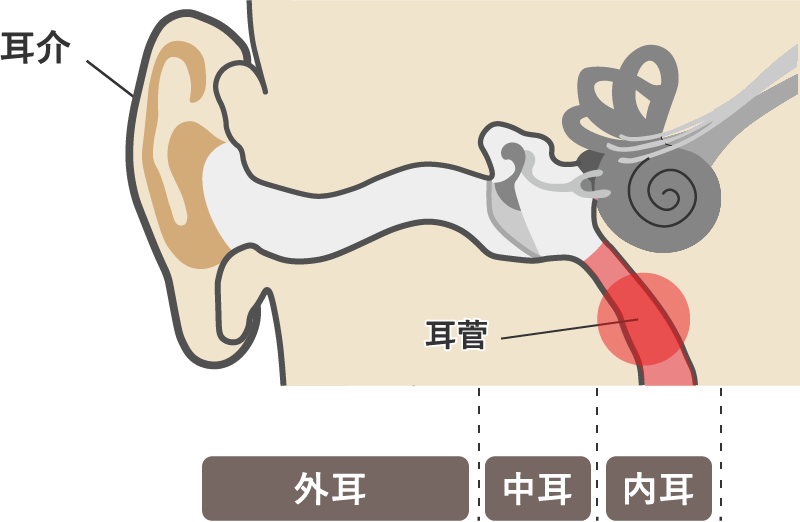 耳管機能障害