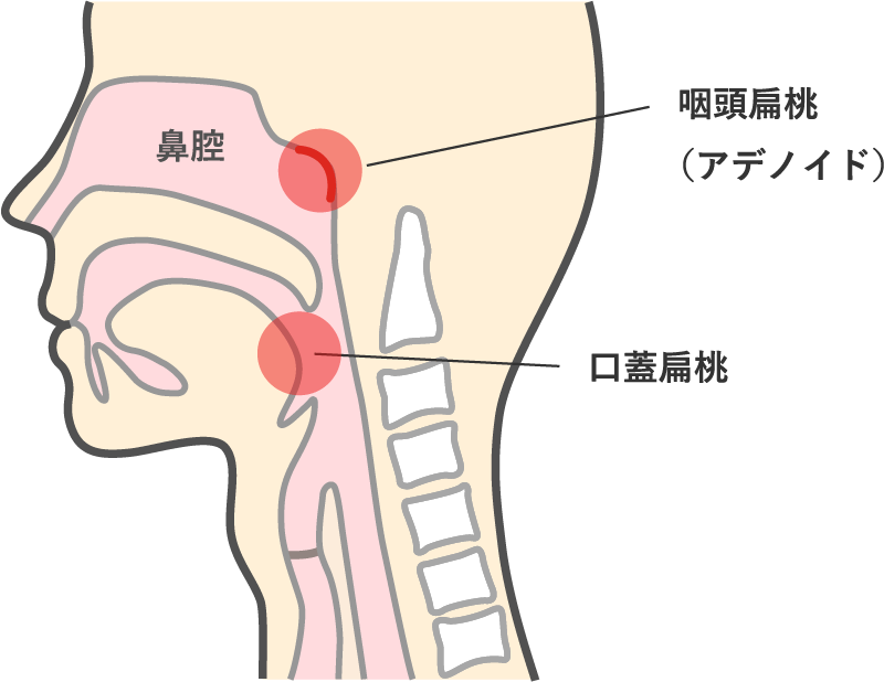 扁桃肥大・アデノイド増殖症