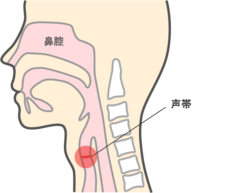 声帯炎