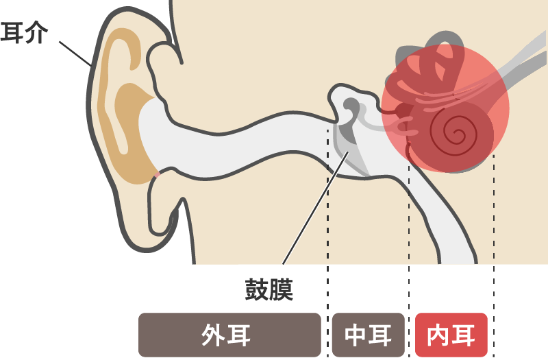 メニエール病