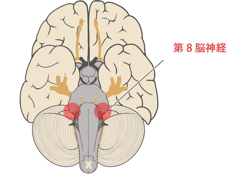 聴神経腫瘍